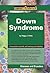 Down Syndrome (Compact Research: Diseases & Disorders)