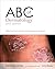 ABC of Dermatology