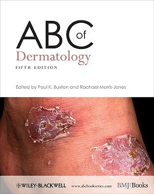 ABC of Dermatology (Paperback)