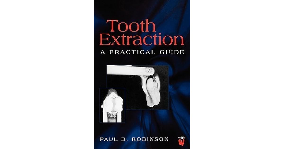 Tooth Extraction A Practical Guide by Paul D. Robinson