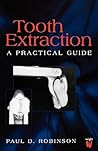 Tooth Extraction:...