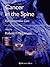 Cancer in the Spine: Comprehensive Care (Current Clinical Oncology)