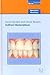 Indirect Restorations