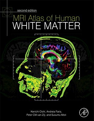 MRI Atlas of Human White Matter (Hardcover)