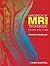 Handbook of MRI Technique