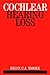 Cochlear Hearing Loss