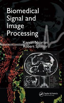 Biomedical Signal and Image Processing (Hardcover)