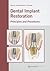Dental Implant Restoration: Principles and Procedures