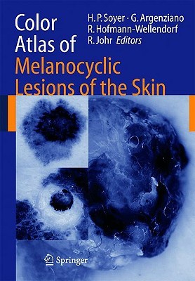 Color Atlas of Melanocytic Lesions of the Skin (Hardcover)