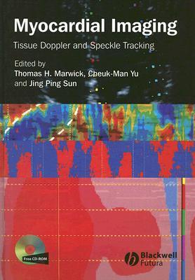 Myocardial Imaging: Tissue Doppler and Speckle Tracking (Hardcover)