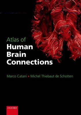 Atlas of Human Brain Connections (Hardcover)