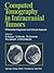 Computed Tomography in Intracranial Tumors: Differential Diagnosis and Clinical Aspects