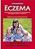 Eczema