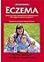 Eczema
