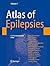 Atlas of Epilepsies