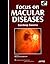 Focus on Macular Diseases