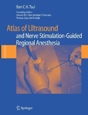 Atlas of Ultrasound- and Nerve Stimulation-Guided Regional Anesthesia (Hardcover)