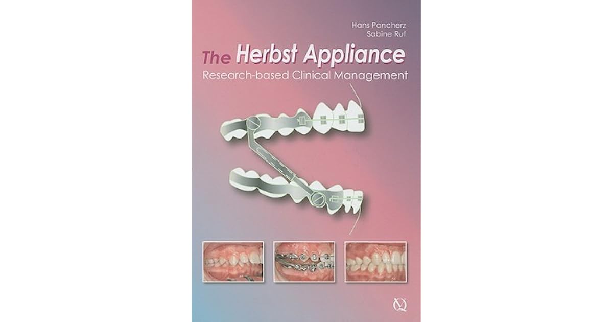 The Herbst Appliance ResearchBased Clinical Management by Hans Pancherz
