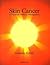 Skin Cancer: A Practical Gu...