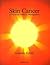 Skin Cancer by Graham B. Colver