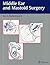 Middle Ear and Mastoid Surgery