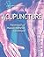 Acupuncture: Treatment of M...