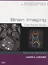 Brain Imaging: Case Review Series