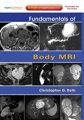 Fundamentals of Body MRI (Paperback)