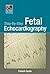 Step-by-Step Fetal Echocardiography