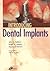 Introducing Dental Implants