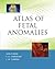 Atlas of Fetal Anomalies