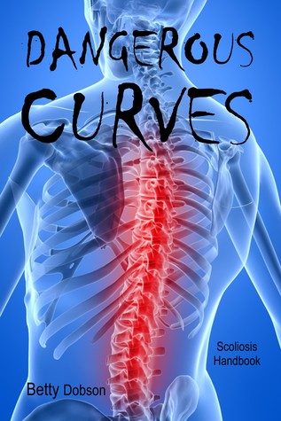 Dangerous Curves