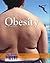 Obesity (Issues That Concern You)