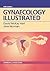Gynaecology Illustrated by David McKay Hart