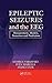 Epileptic Seizures and the ...