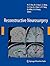 Reconstructive Neurosurgery...