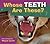Whose Teeth Are These? (Who...
