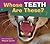 Whose Teeth Are These? (Whose? Animal Series)