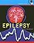 Epilepsy