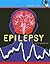 Epilepsy
