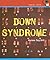 Down Syndrome (Health Aleart)