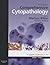 Comprehensive Cytopathology: Expert Consult: Online and Print