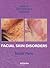 Facial Skin Disorders (Series in Dermatological Treatment)