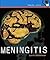 Meningitis (Health Aleart)