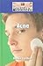 Acne (Diseases and Disorders)