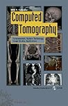 Computed Tomography: Fundamentals, System Technology, Image Quality, Applications