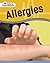 Allergies (How's Your Health?)