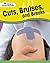 Cuts, Bruises, and Breaks (How's Your Health?)