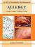 Allergy: An Atlas of Investigation and Diagnosis