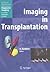 Imaging in Transplantation (Medical Radiology)